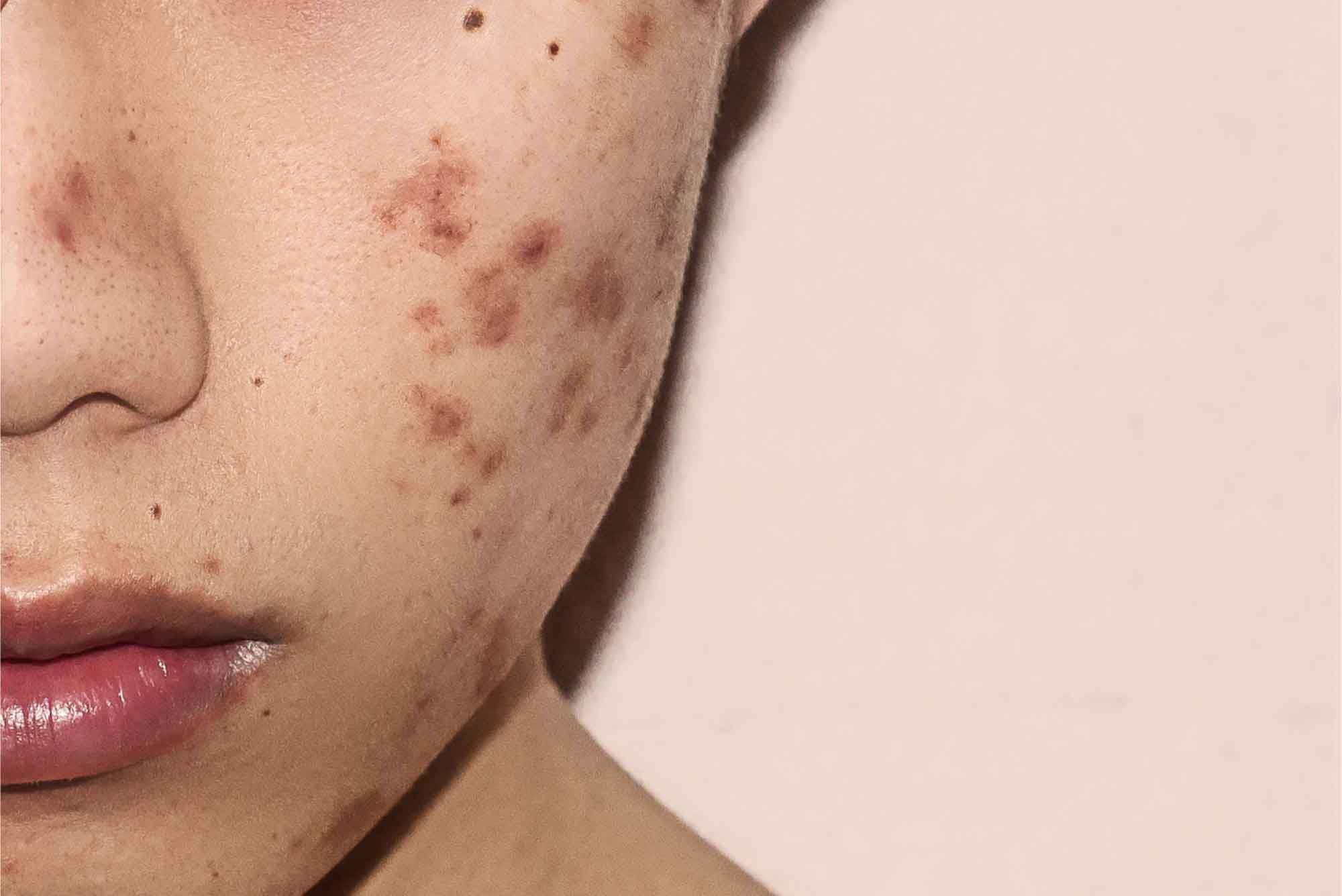 Image of Skincare Menstrual Cycle